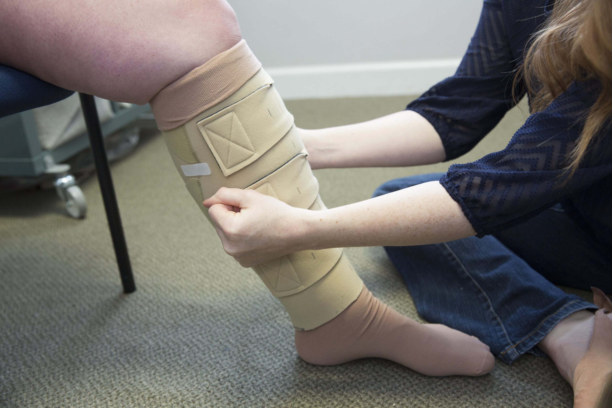Lymphedema – SPOT Rehab and Home Care