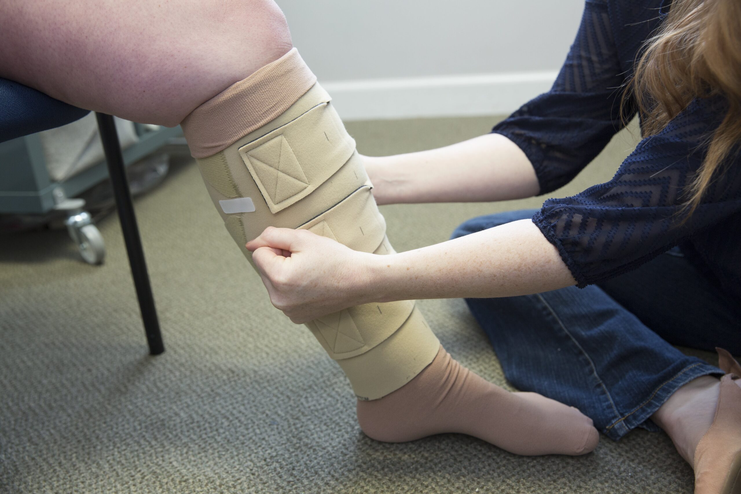 What Is Complete Decongestive Therapy? - Tactile Medical